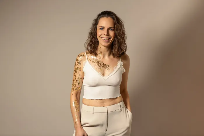 Juliane Klüß lacht in die Kamera, ihre Narben an Arm und Brust sind mit Blattgold belegt